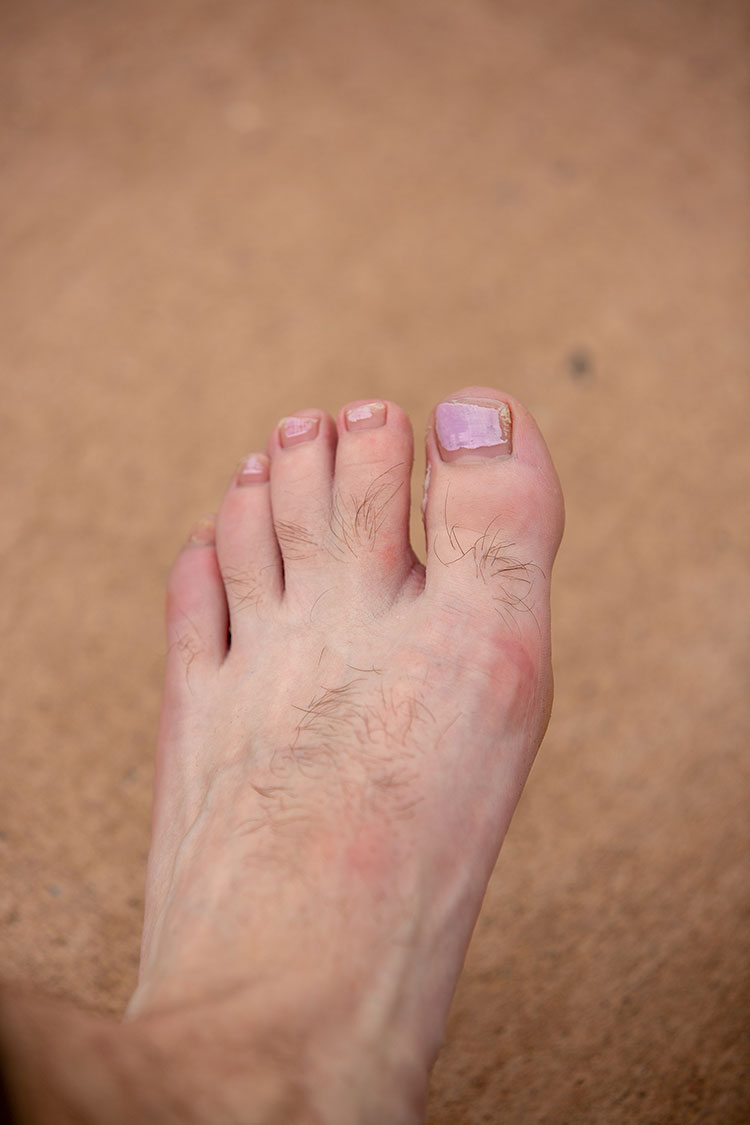 7 Agush Agushi Webbed Toes 750px